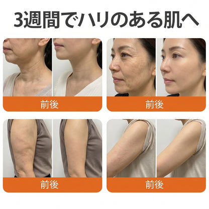 🧑‍⚕️PuraCure® ビーベノム リペア再生クリーム🔥天然由来のエイジングケアで肌を引き締め、ハリを与え、乾燥による小ジワを目立たなくします – 50mL